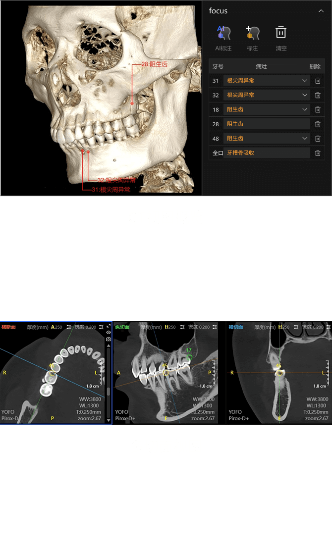 口腔CT智能報告