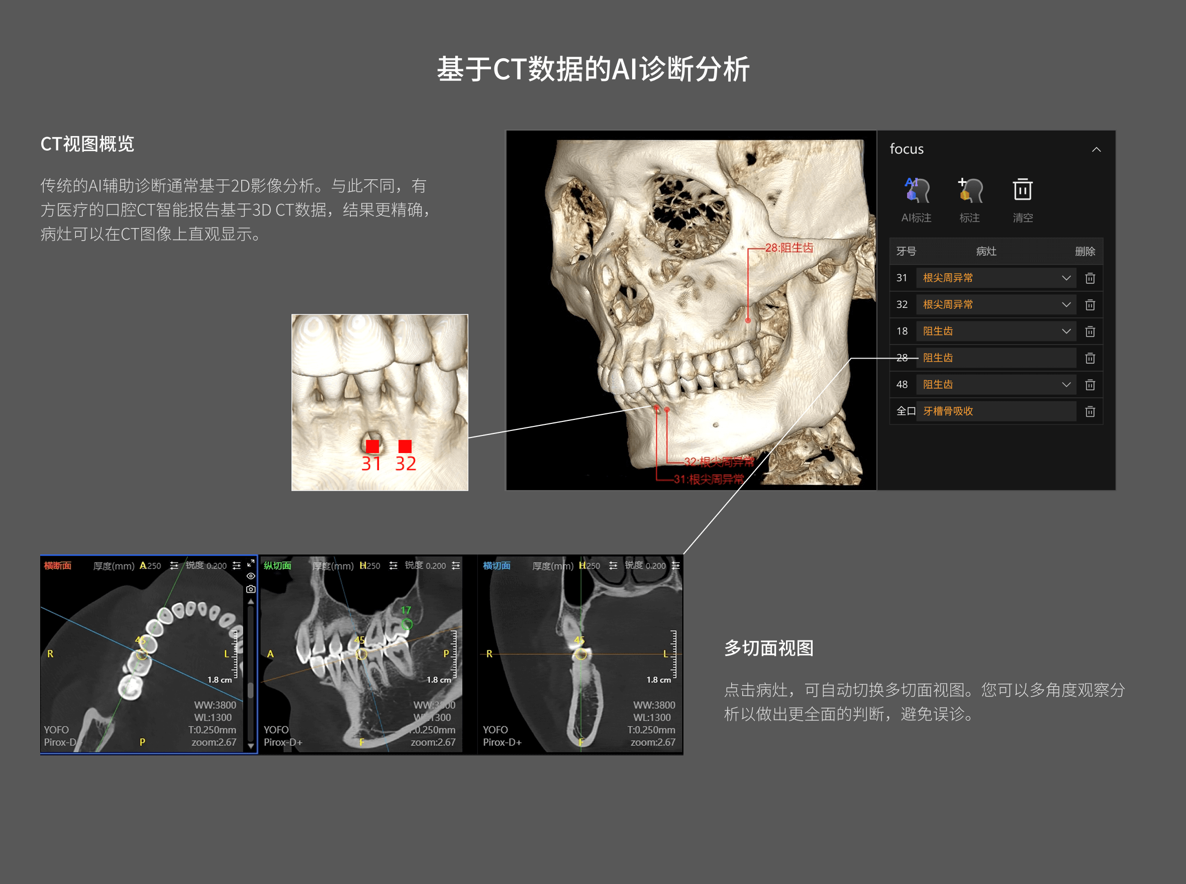 口腔CT智能報告