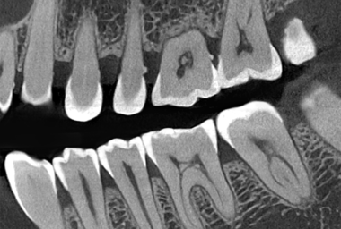 40lp/cm超高清成像