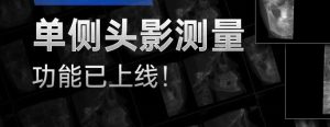 有方口腔CT單側頭影測量功能已上線！