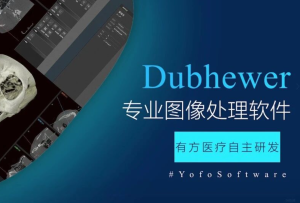 有方派CT影像中心——Dubhewer全新功能先睹為快！